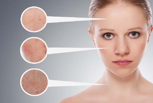 Skin Conditions