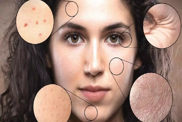 Skin Care