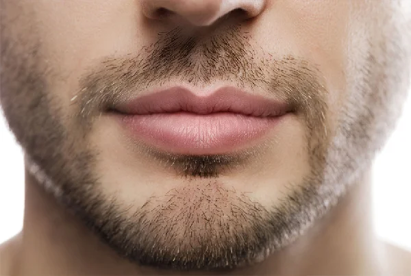 Lip Lightening Treatment