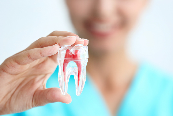 Root Canal