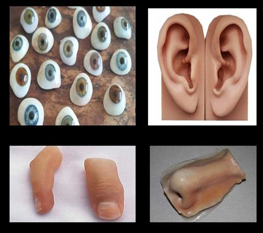 Maxillofacial Prosthesis